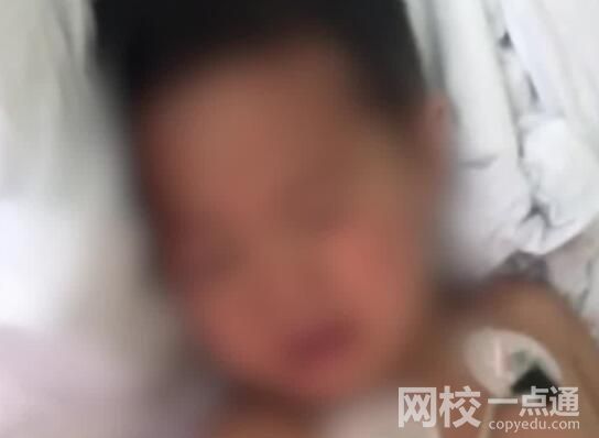 3歲男童路遇烈犬掙脫狗繩撕咬 內(nèi)幕曝光簡直太意外了