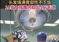 女孩吃頭發(fā)胃里取出5斤毛球 具體是什么情況?