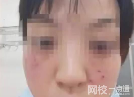 警方回應(yīng)家長(zhǎng)帶娃上門道歉被打傷 具體是什么情況?