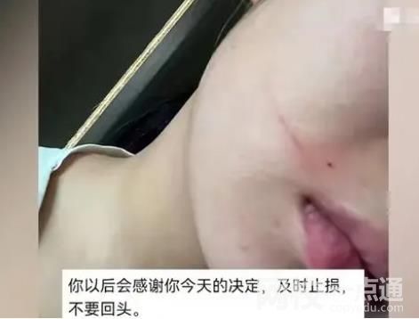 女子懷孕近7個(gè)月被丈夫施暴 具體是什么情況?