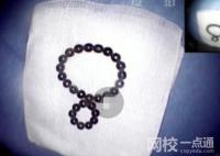 2歲幼童誤吞28顆磁力珠 內(nèi)幕曝光簡(jiǎn)直太意外了