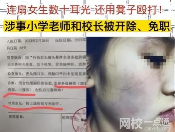 連扇學生數(shù)十耳光涉事老師被拘 內(nèi)幕曝光簡直太意外了