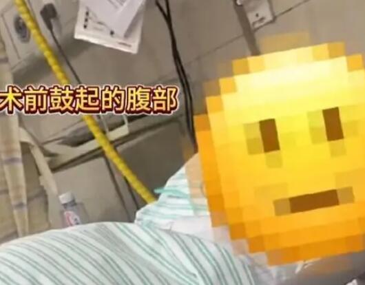 女子便秘20多年差點(diǎn)撐爆肚子 是什么原因造成的？
