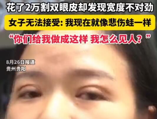 女子花2萬(wàn)割雙眼皮控訴成了悲傷蛙 實(shí)在太悲劇了