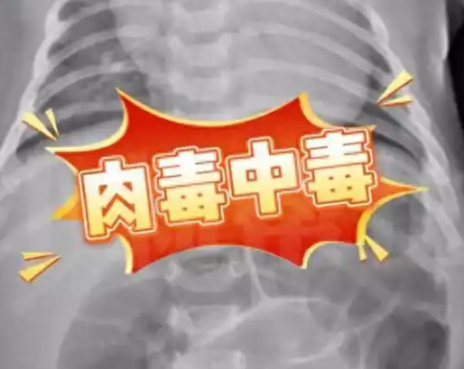 52天嬰兒喝奶奶喂的蜂蜜水中毒進ICU 究竟是怎么回事？