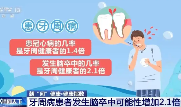 牙周病患者腦卒中可能性大增 到底是不是真的？