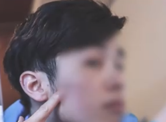 24歲小伙覺(jué)得自己太丑竟燒炭輕生 實(shí)在太嚇人了
