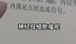 女孩因個(gè)矮去體檢發(fā)現(xiàn)腎上長腫瘤 這也太恐怖了