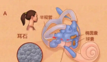 25歲女子長期熬夜打麻將患耳石癥 究竟是怎么回事？