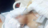 貴州一男子被野豬咬成重傷 究竟是怎么回事？
