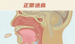 26歲女孩突發(fā)會(huì)厭炎僅10分鐘去世 實(shí)在太可怕了