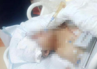 貴州一男子被野豬咬成重傷 究竟是怎么回事？