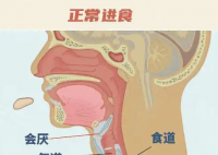 26歲女孩突發(fā)會厭炎僅10分鐘去世 實在太可怕了