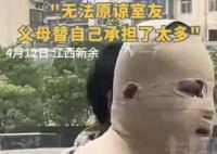 全身90%燒傷男生說父母借錢太心酸 究竟是怎么回事？