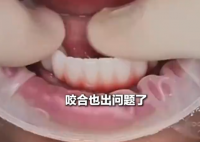 女子花6萬植12顆牙2年調(diào)試20多次 究竟是怎么回事？